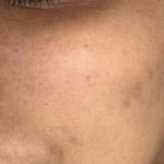 Glowmica Skin Brightening Face Serum photo review