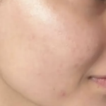 Glowmica Skin Brightening Face Serum photo review