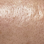 Glowmica Skin Brightening Face Serum photo review