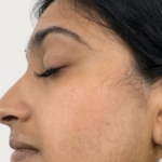 Glowmica Skin Brightening Face Serum photo review